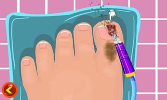 Toe Surgery Doctor Game