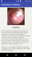 Small Atlas of Otoscopy