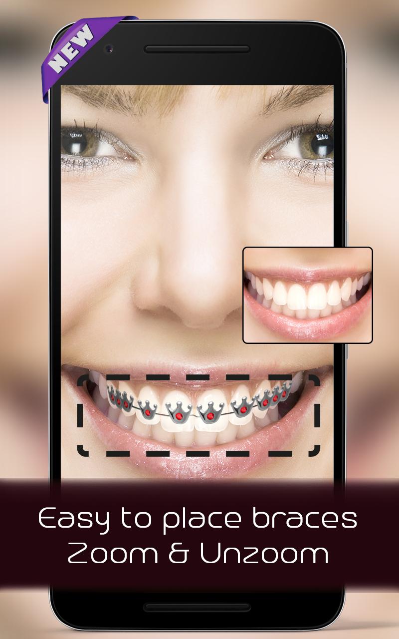 Braces on teeth Photo editor