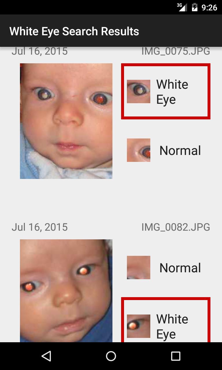 CRADLE White Eye Detector