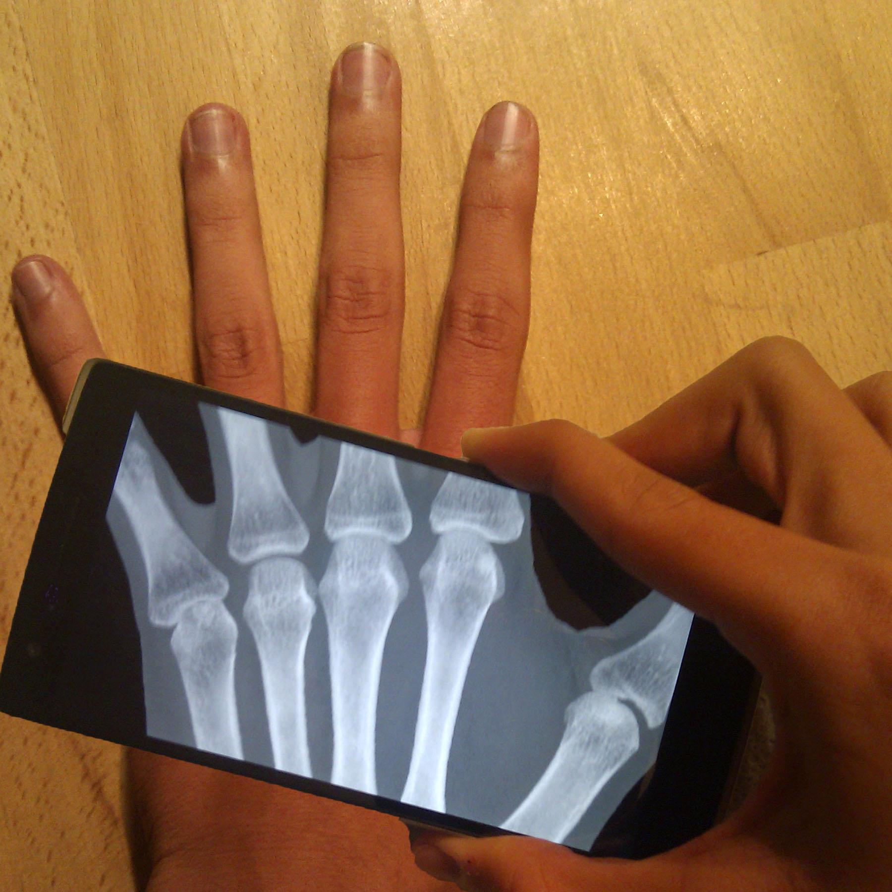 Ultimate X-Ray Scanner