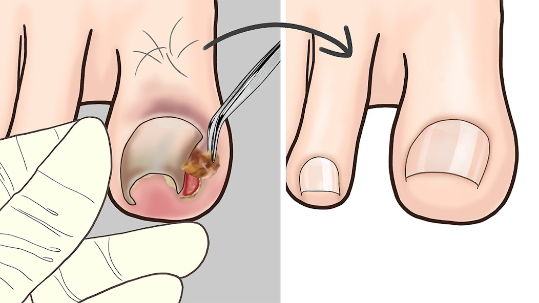 ASMR Salon Foot Care Makeover