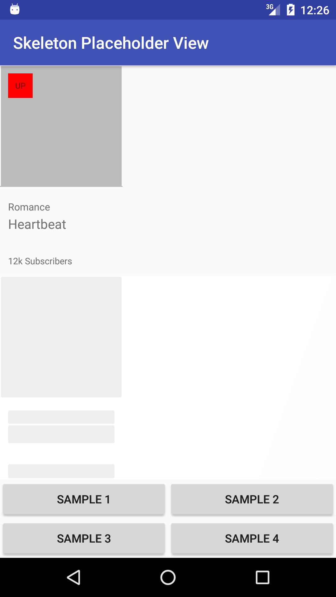 Skeleton Placeholder View