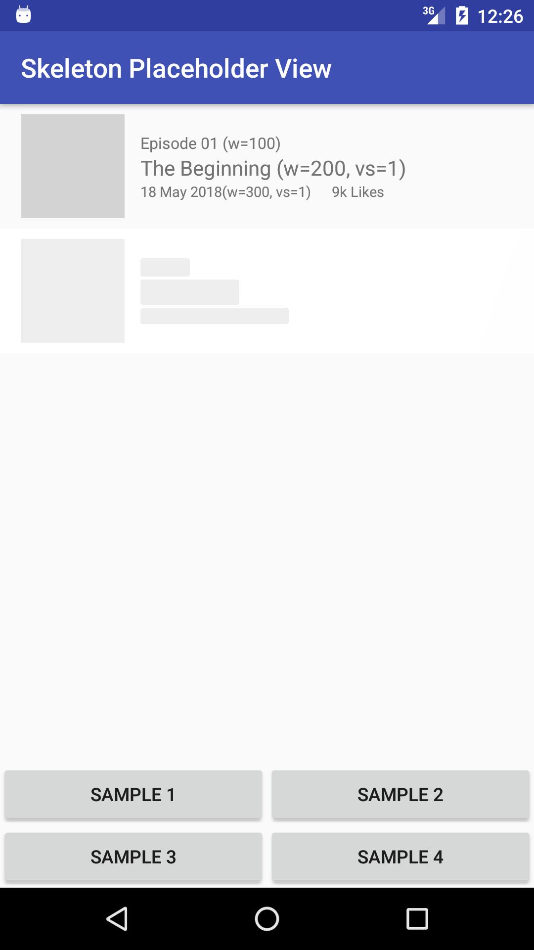 Skeleton Placeholder View