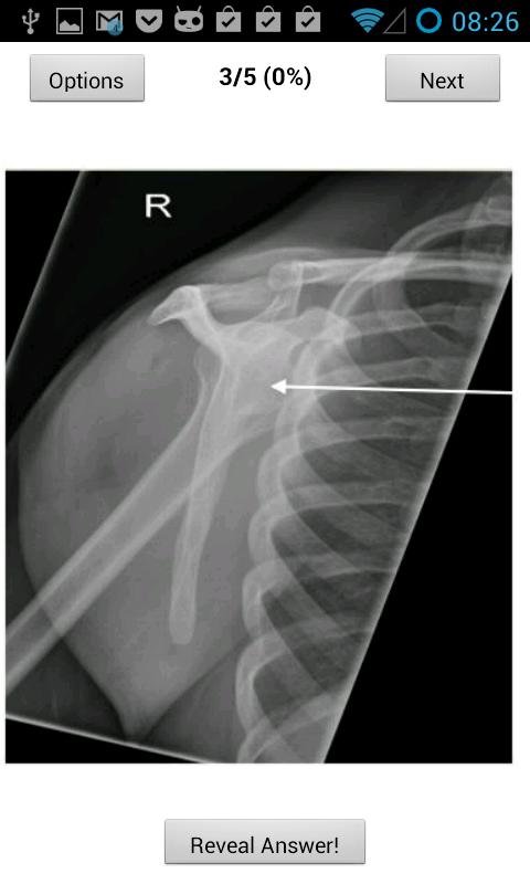 Powerpass FRCR Anatomy 2013