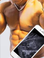 Ultrasound Scanner Sonography